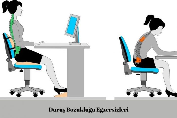 Duruş Bozukluğu Egzersizleri