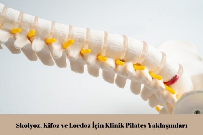 Skolyoz, Kifoz ve Lordoz İçin Klinik Pilates Yaklaşımları
